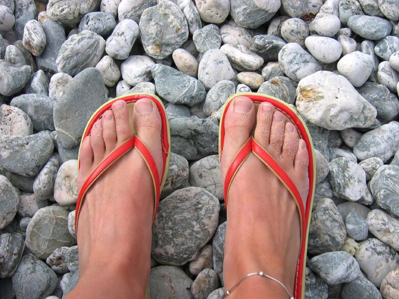 caminar con zapatos en la playa para prevenir hongos