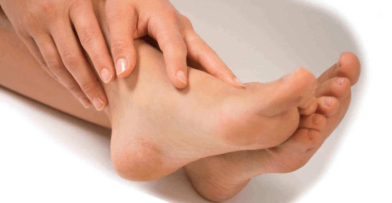 La infección por hongos puede afectar la piel entre los dedos de los pies. 