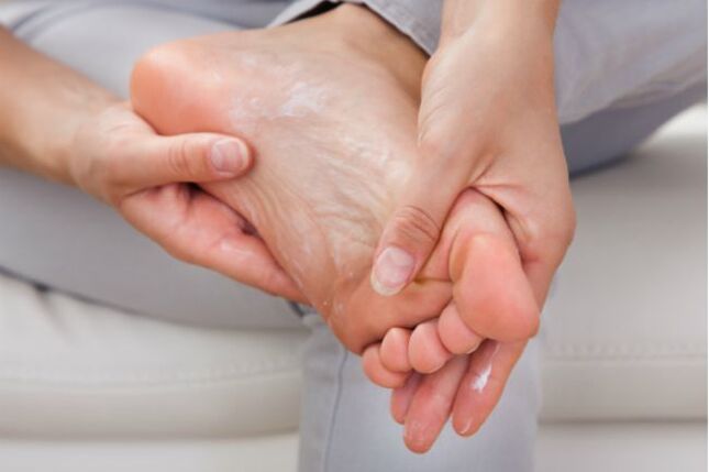 Las cremas y gotas antimicóticas ayudarán en las etapas iniciales de los hongos en las uñas de los pies. 