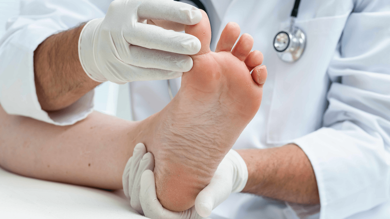 examen de la piel de las piernas en una cita con un especialista