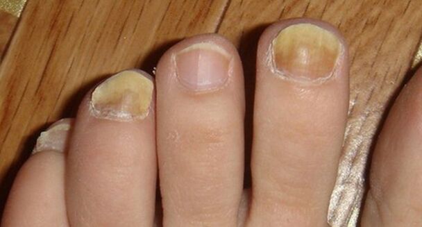 Cambiar el color y la estructura de las uñas