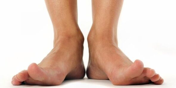 hongos en los pies
