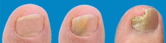 Proceso de desarrollo de hongos.