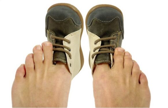 Cómo reconocer los hongos en las uñas de los pies por síntomas.